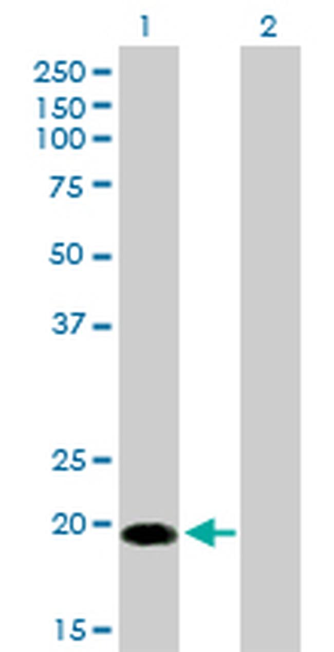 CETN1 Antibody in Western Blot (WB)