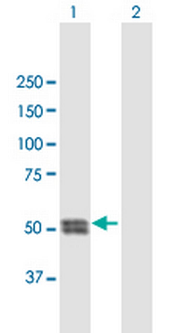 CTSC Antibody in Western Blot (WB)