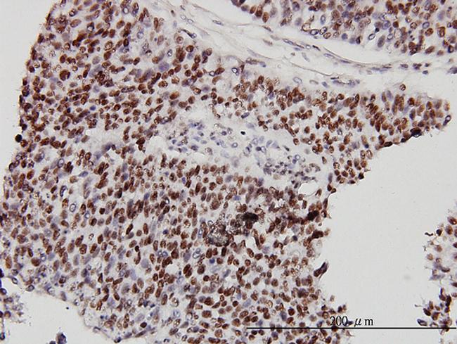 CHD4 Antibody in Immunohistochemistry (Paraffin) (IHC (P))