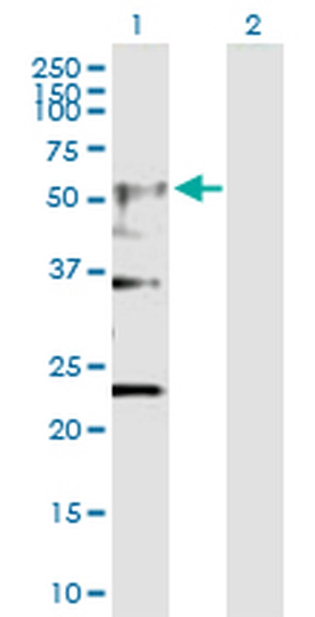 CHRNA4 Antibody in Western Blot (WB)