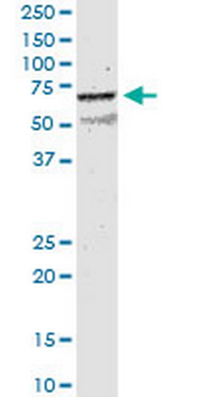 CHRNB2 Antibody in Western Blot (WB)