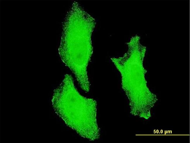 CHUK Antibody in Immunocytochemistry (ICC/IF)