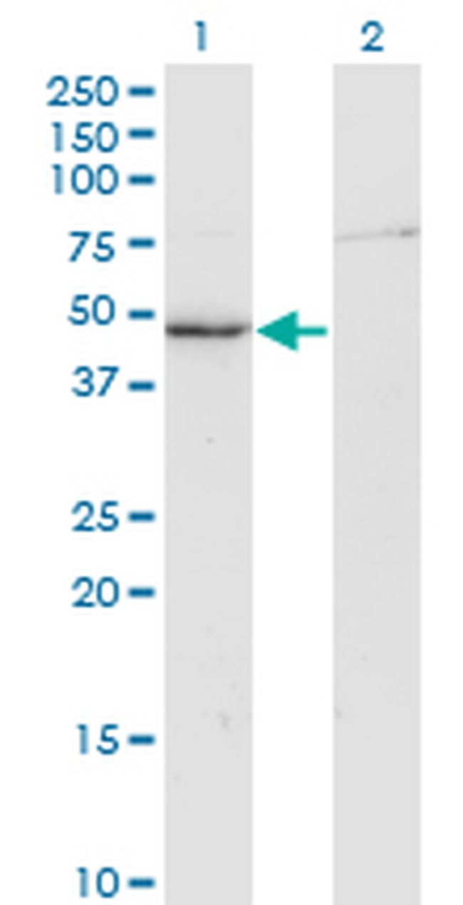 CKM Antibody in Western Blot (WB)