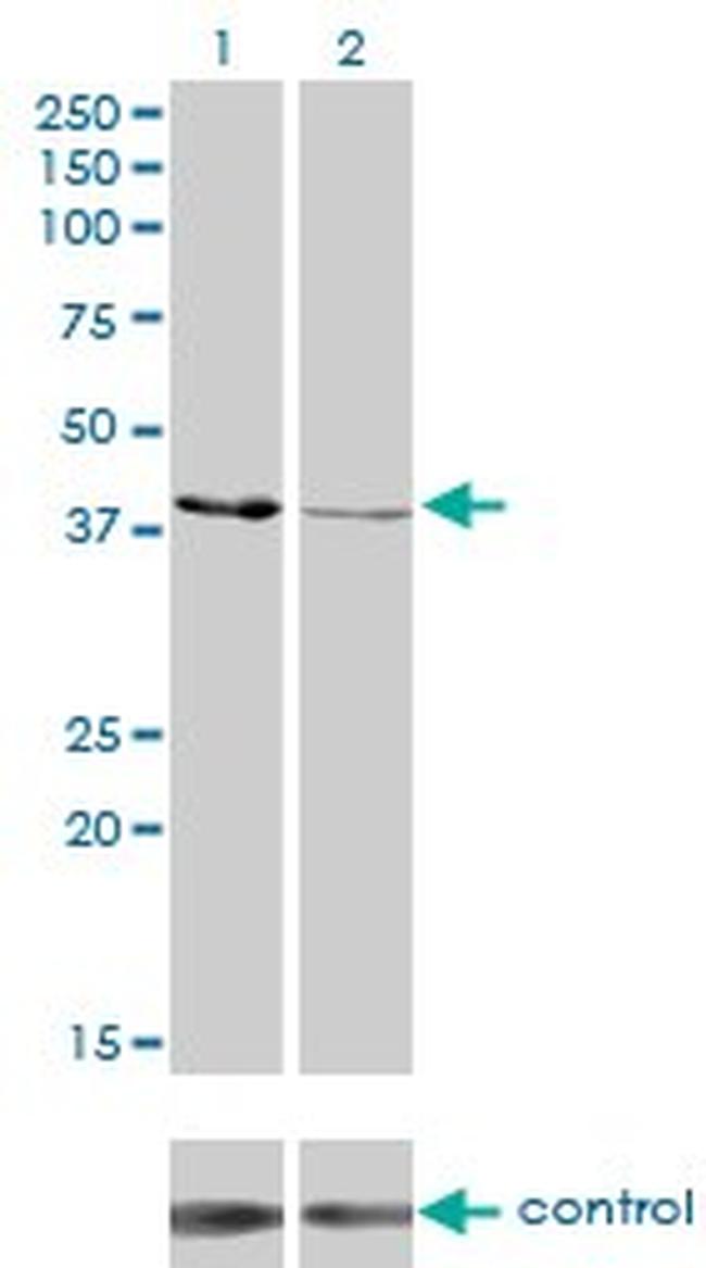 CKMT1B Antibody in Western Blot (WB)