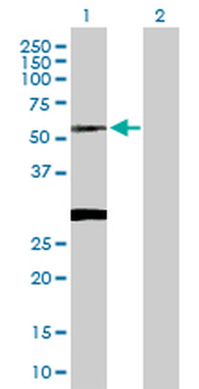 CLN3 Antibody in Western Blot (WB)