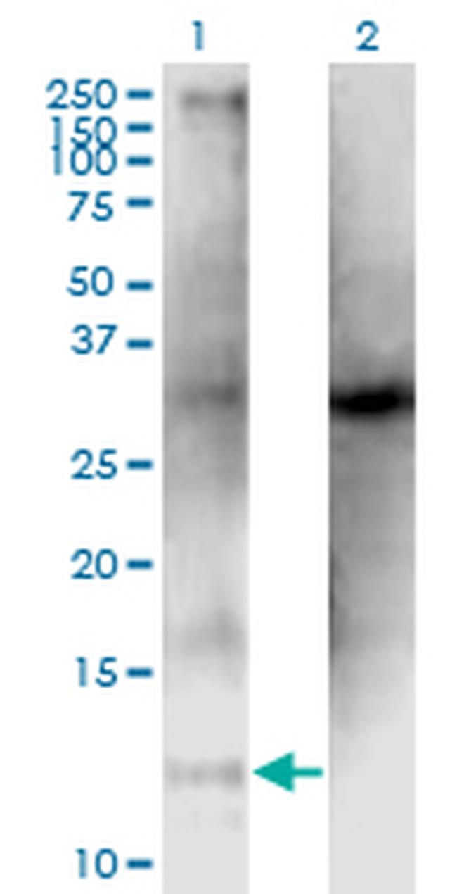 CLPS Antibody in Western Blot (WB)