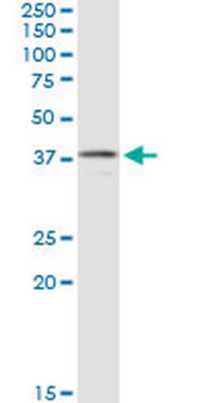 CNN3 Antibody in Western Blot (WB)