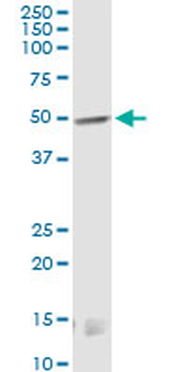 CNR1 Antibody in Western Blot (WB)