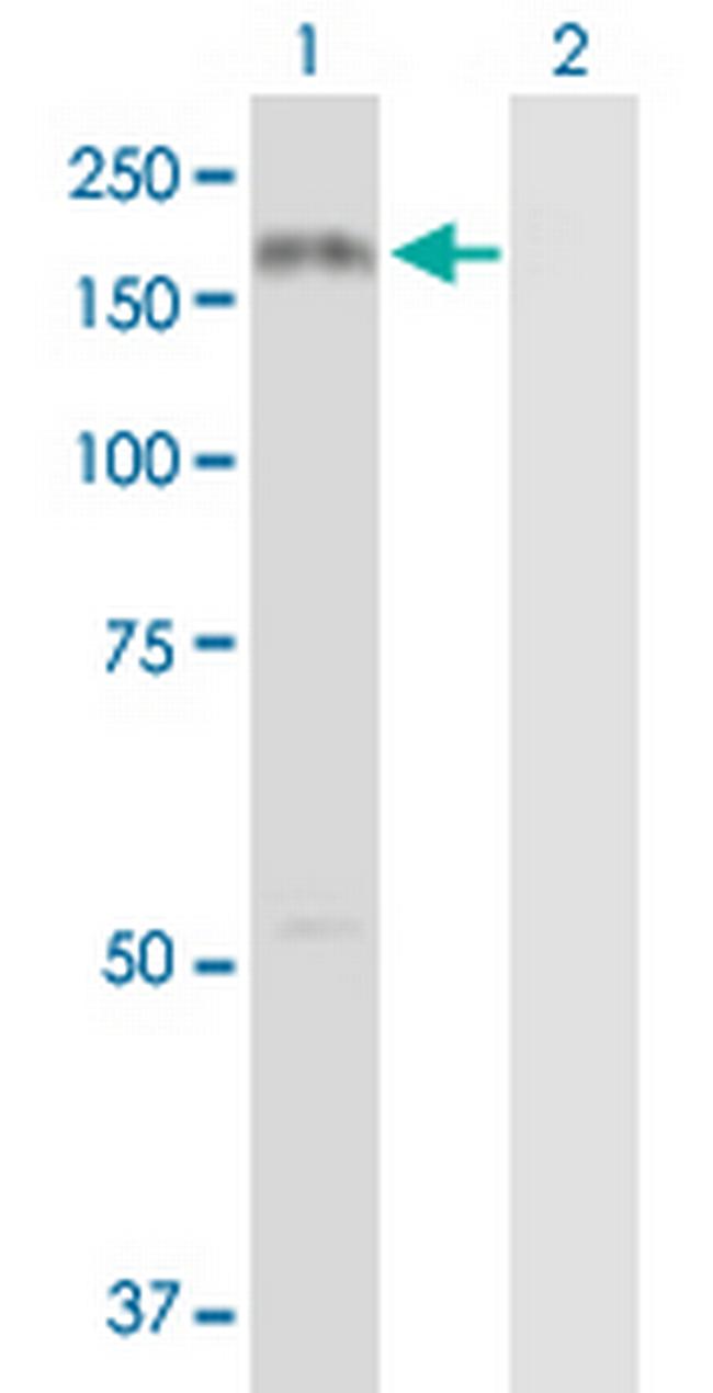 COL3A1 Antibody in Western Blot (WB)