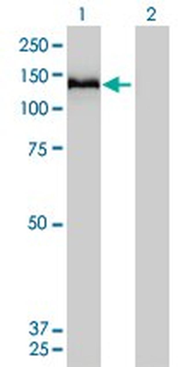 COL6A2 Antibody in Western Blot (WB)