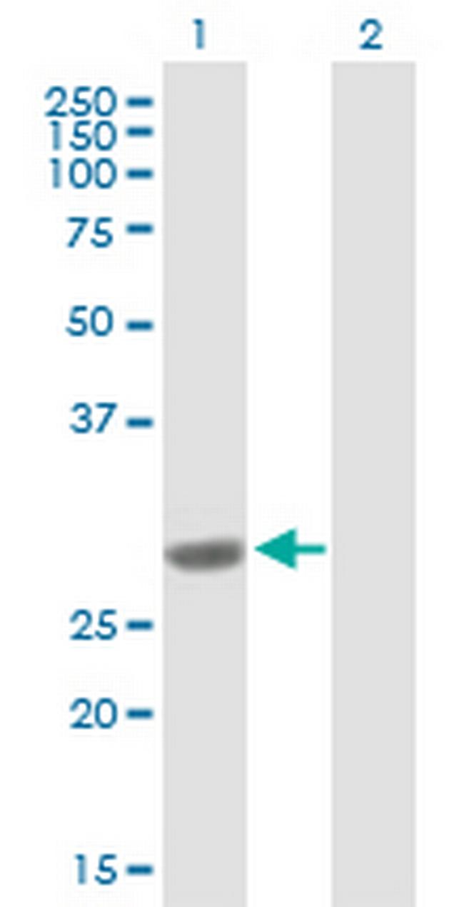 COMT Antibody in Western Blot (WB)