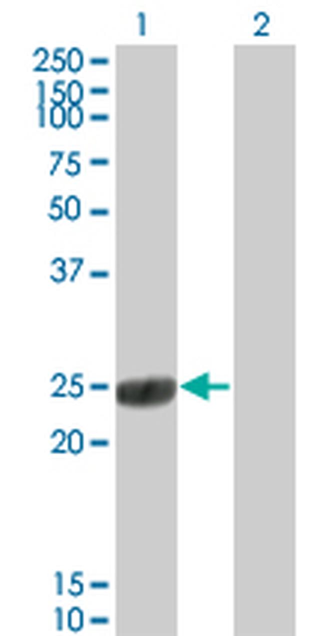 COMT Antibody in Western Blot (WB)