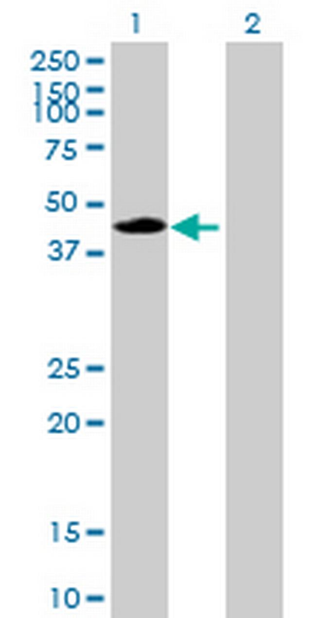 CPA1 Antibody in Western Blot (WB)