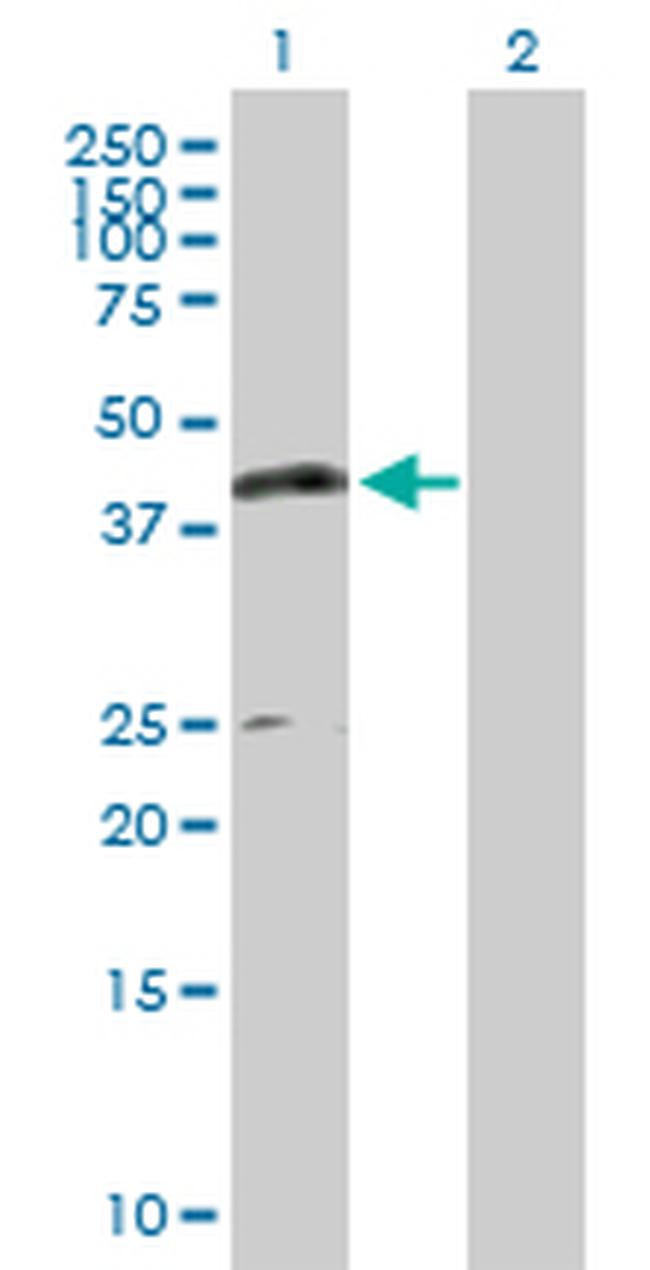 CPA1 Antibody in Western Blot (WB)