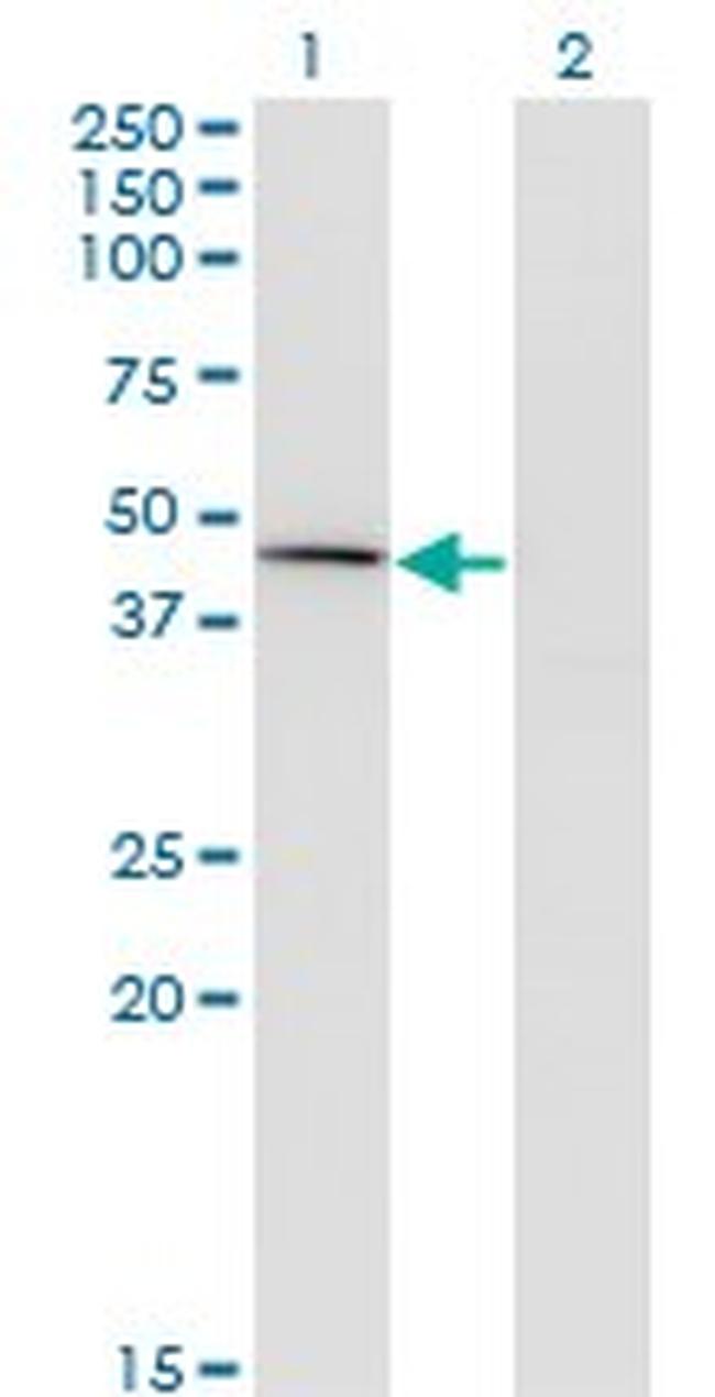 CPA1 Antibody in Western Blot (WB)