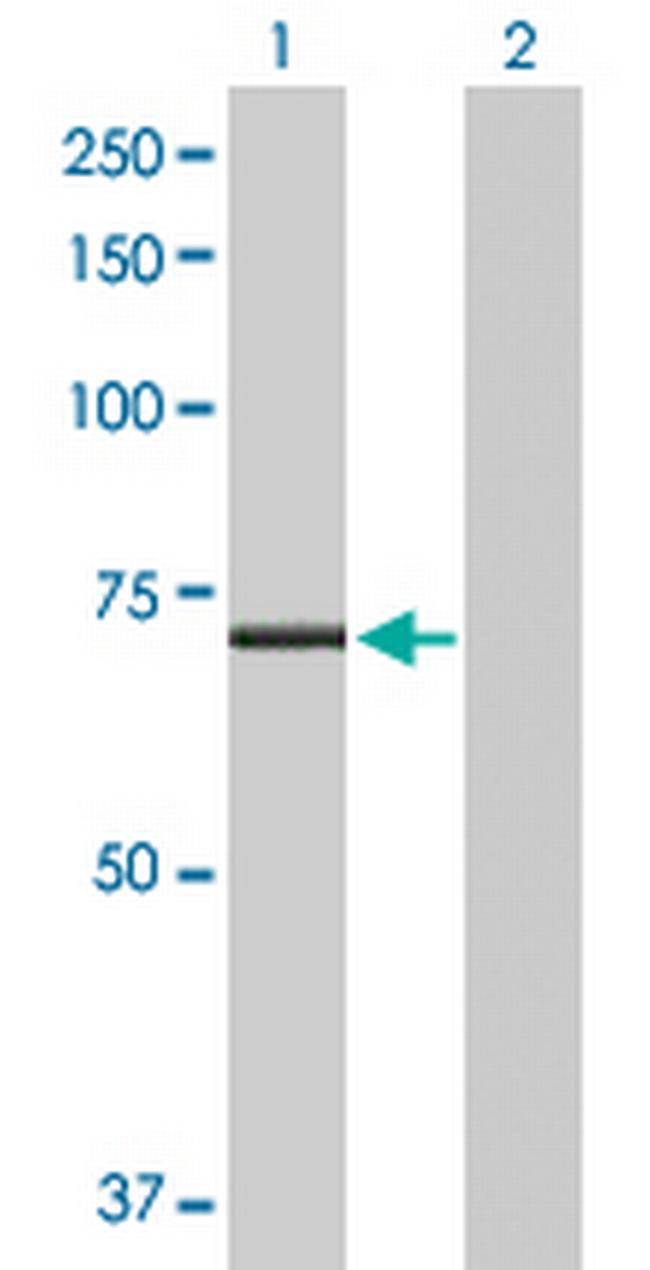 CPT2 Antibody in Western Blot (WB)