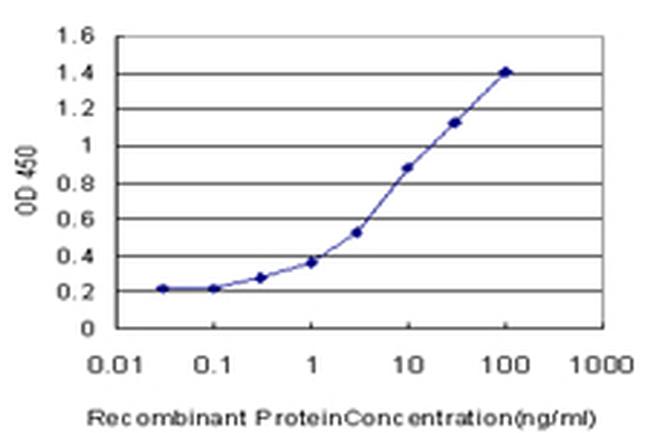 CPT2 Antibody in ELISA (ELISA)