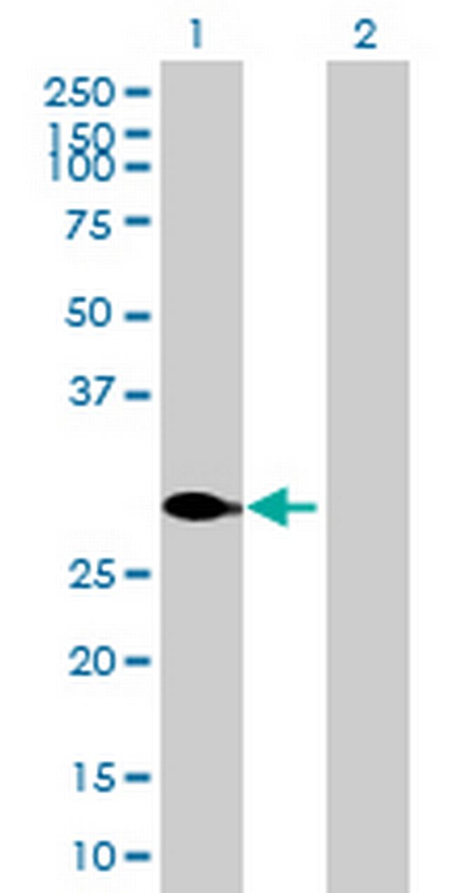 ATF2 Antibody in Western Blot (WB)