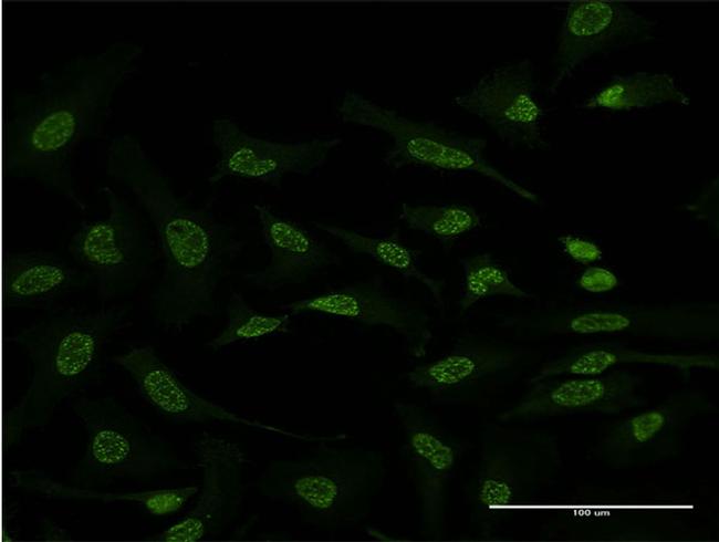 ATF2 Antibody in Immunocytochemistry (ICC/IF)