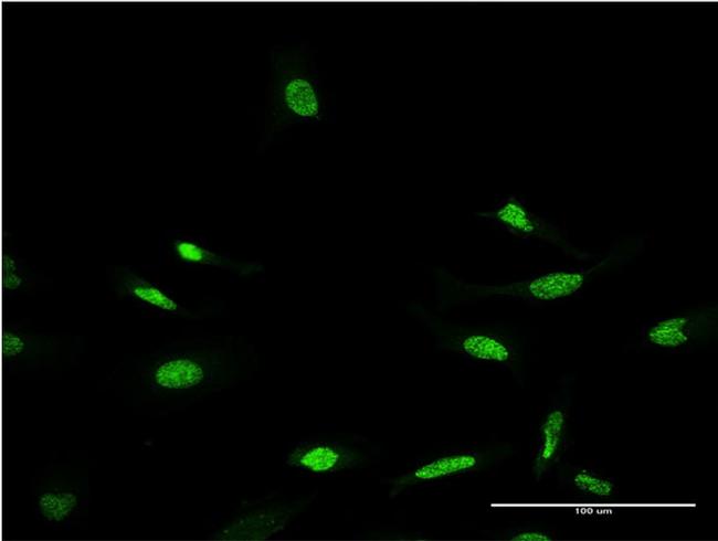 CRX Antibody in Immunocytochemistry (ICC/IF)