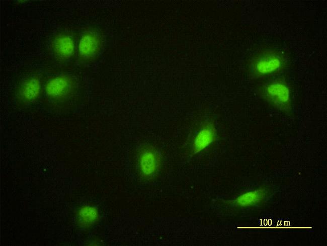 CRY1 Antibody in Immunocytochemistry (ICC/IF)