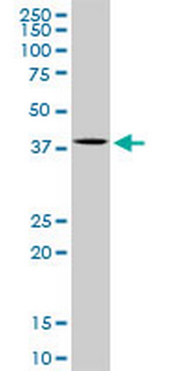 MAPK14 Antibody in Western Blot (WB)