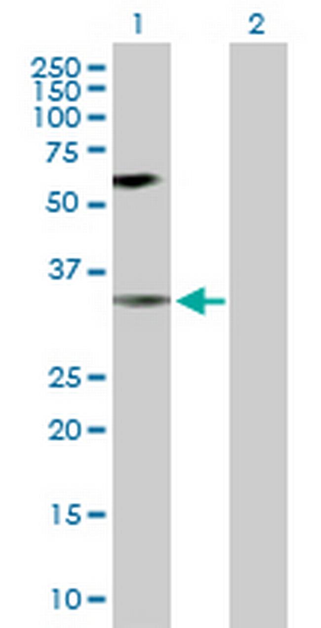 MAPK14 Antibody in Western Blot (WB)