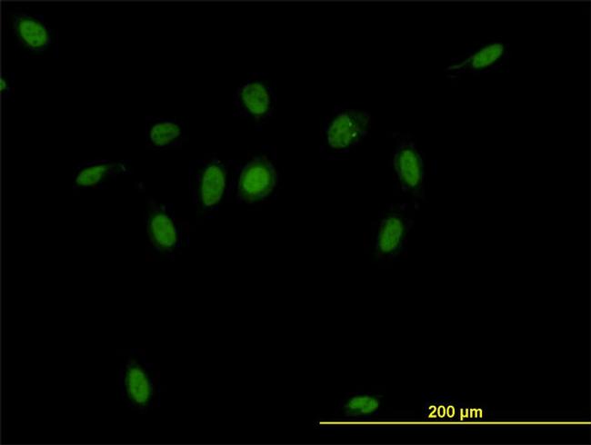 CSE1L Antibody in Immunocytochemistry (ICC/IF)