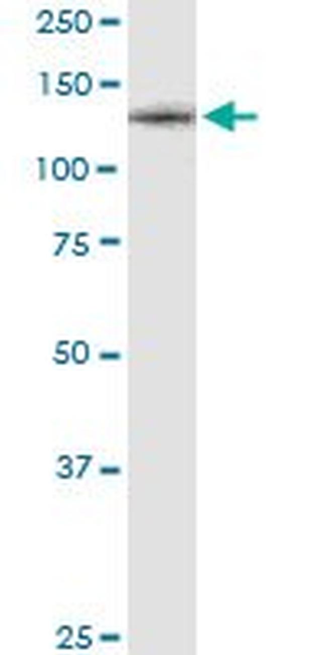 CSF1R Antibody in Western Blot (WB)