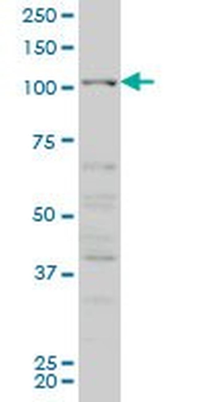 CSF1R Antibody in Western Blot (WB)