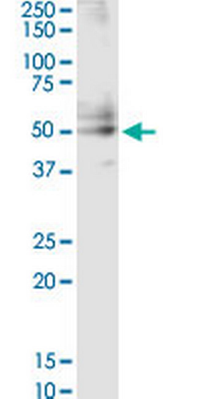 CSF2 Antibody in Western Blot (WB)