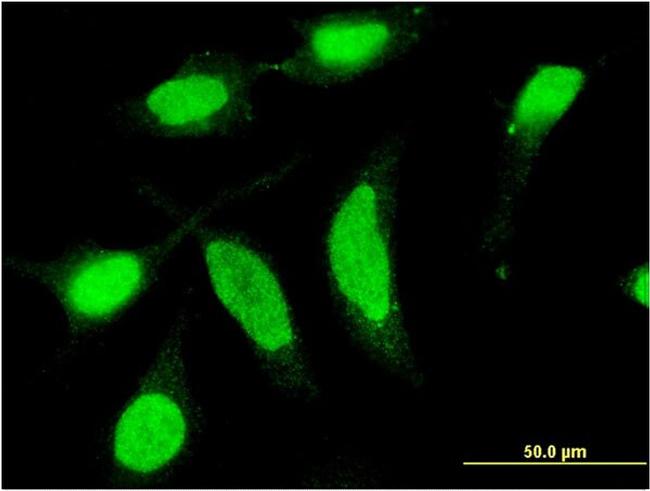 CSNK1D Antibody in Immunocytochemistry (ICC/IF)