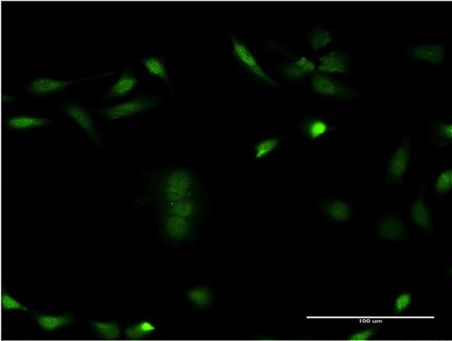 CSNK1E Antibody in Immunocytochemistry (ICC/IF)