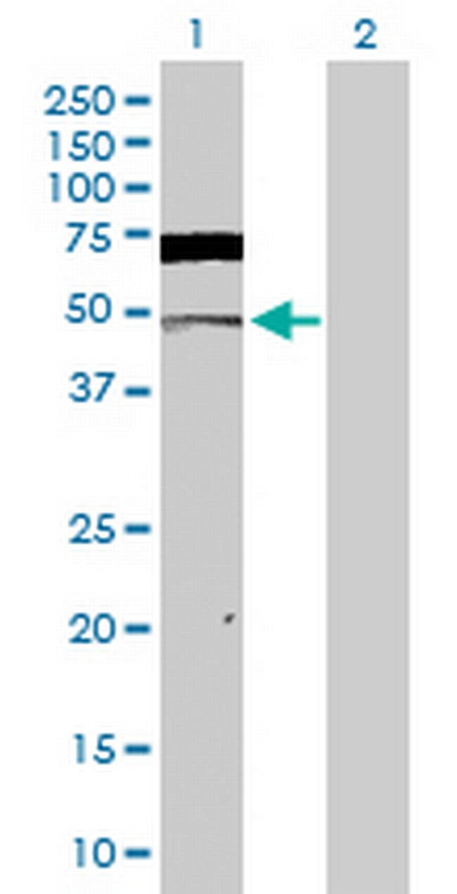 CSNK2A1 Antibody in Western Blot (WB)