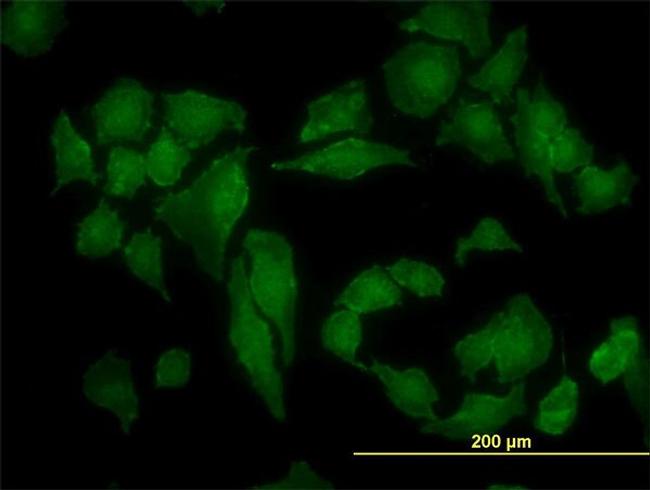 CSNK2A1 Antibody in Immunocytochemistry (ICC/IF)