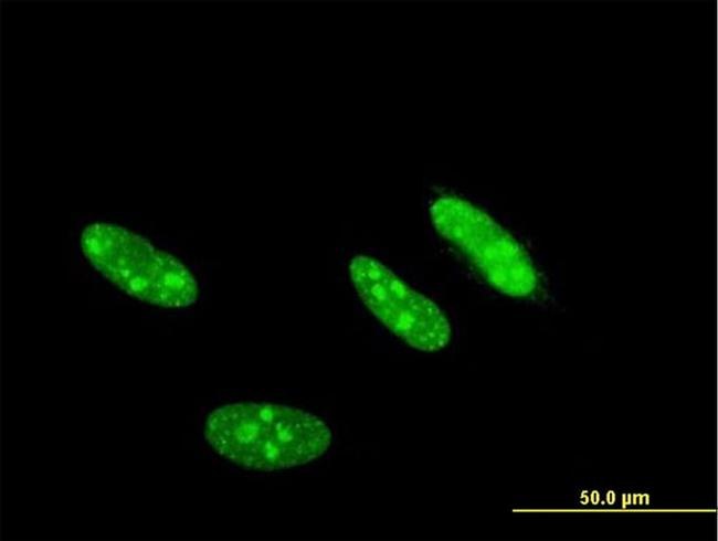 CSNK2A2 Antibody in Immunocytochemistry (ICC/IF)