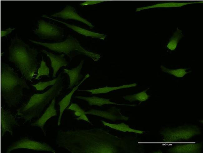 CSNK2A2 Antibody in Immunocytochemistry (ICC/IF)