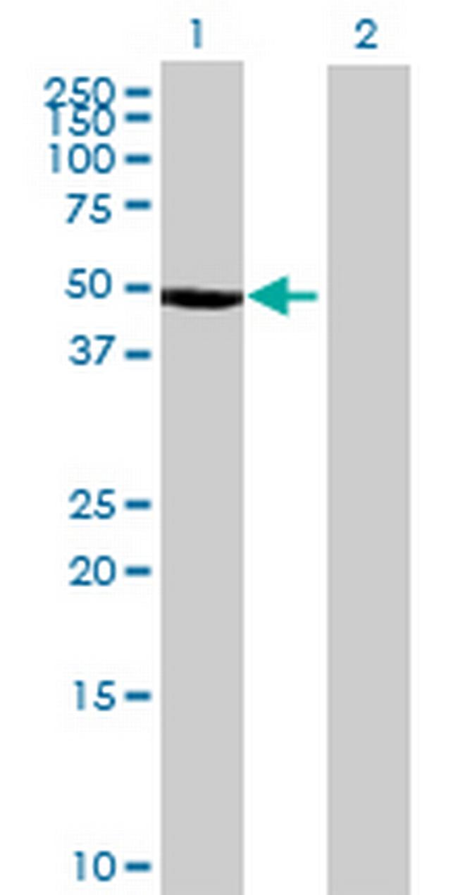 CTBS Antibody in Western Blot (WB)