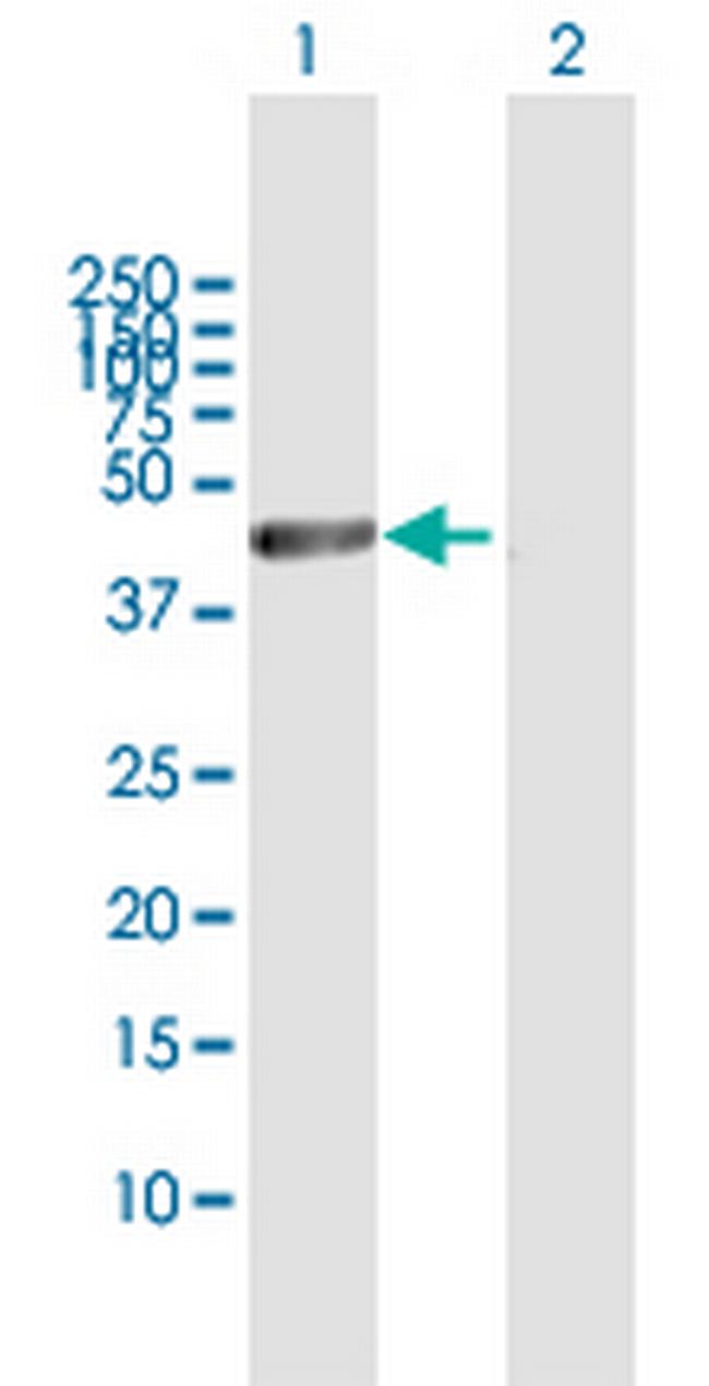 CTBP2 Antibody in Western Blot (WB)