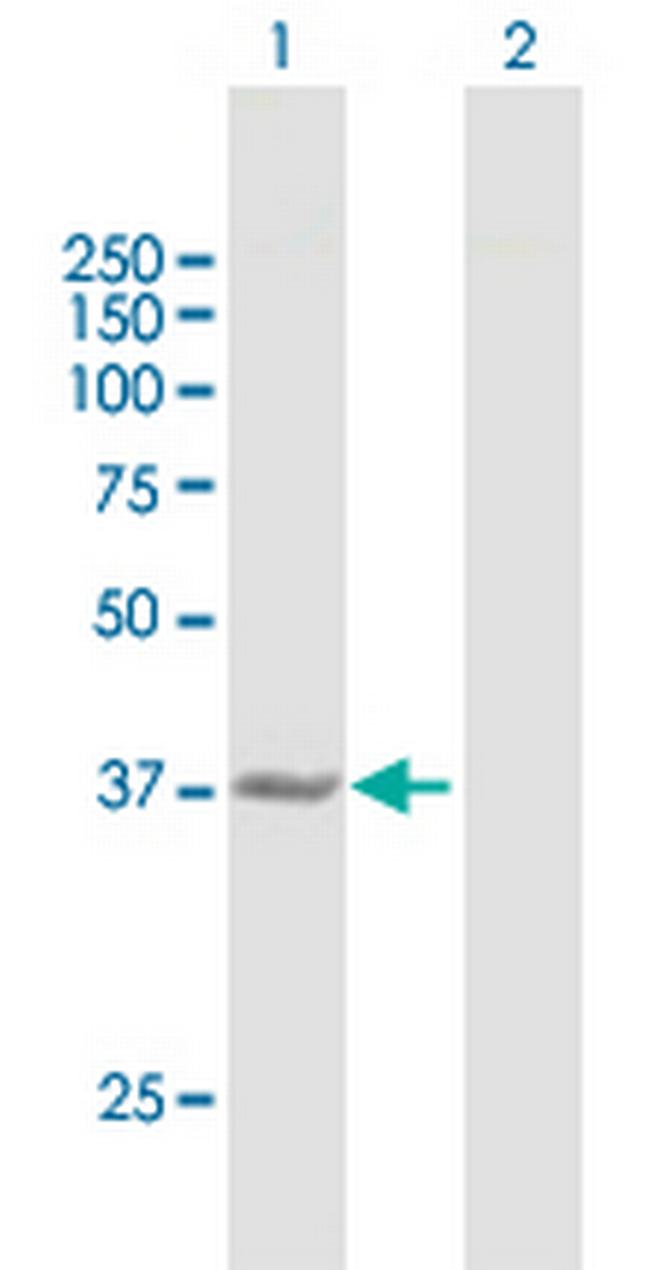 CTH Antibody in Western Blot (WB)