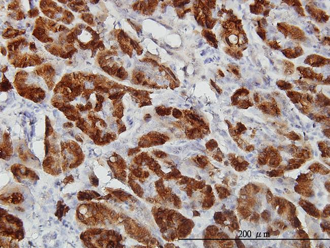 CTH Antibody in Immunohistochemistry (Paraffin) (IHC (P))