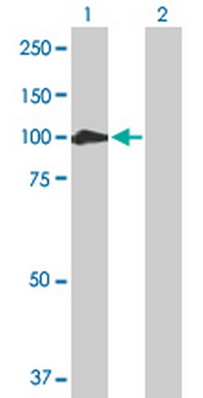 CTNNA2 Antibody in Western Blot (WB)