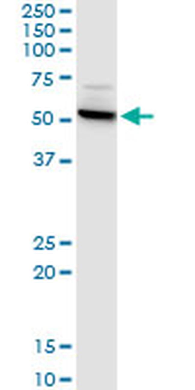 CTNS Antibody in Western Blot (WB)