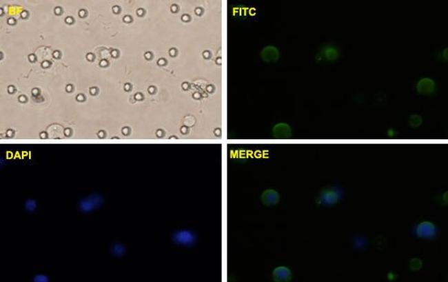 CTNNB1 Antibody in Immunocytochemistry (ICC/IF)