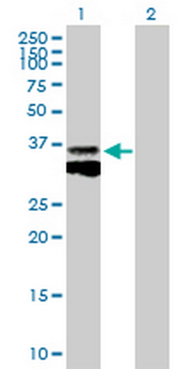 CTSB Antibody in Western Blot (WB)