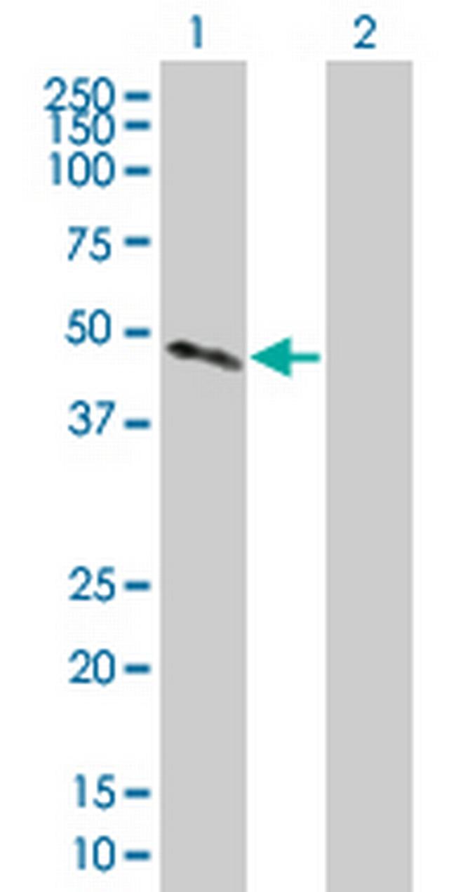 CTSH Antibody in Western Blot (WB)