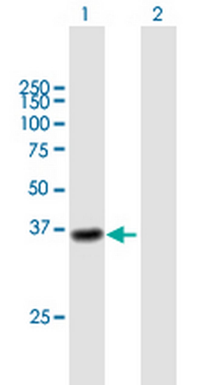 CTSL1 Antibody in Western Blot (WB)