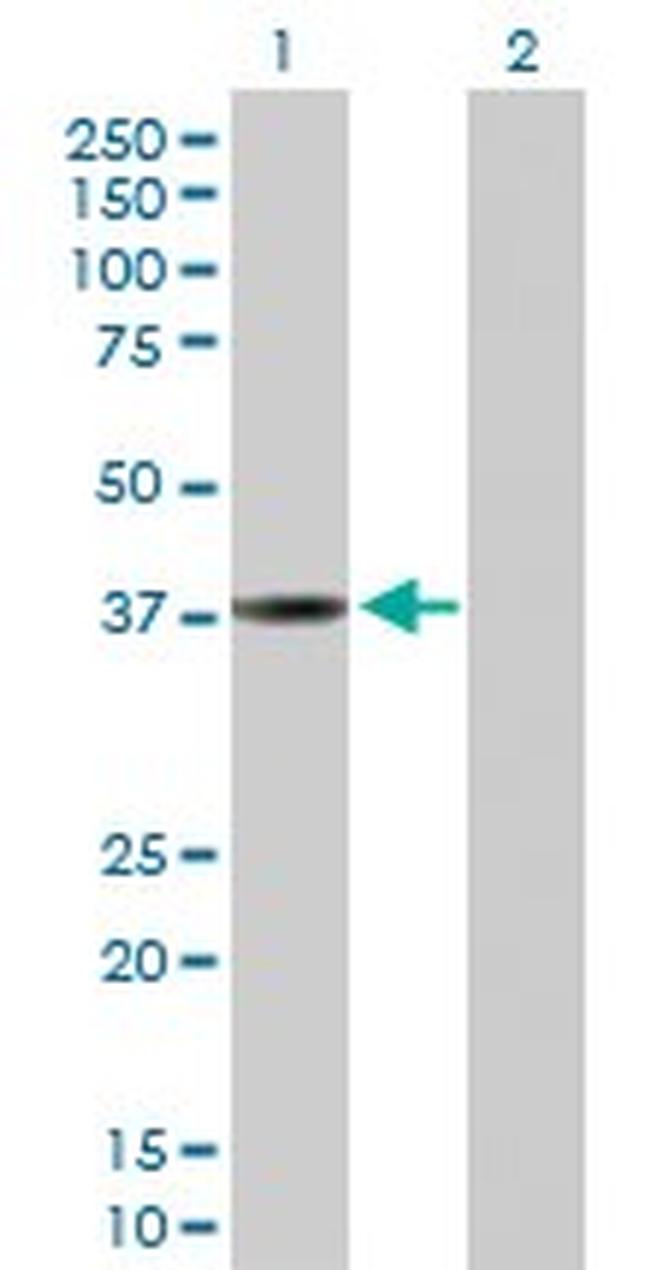 CTSL1 Antibody in Western Blot (WB)