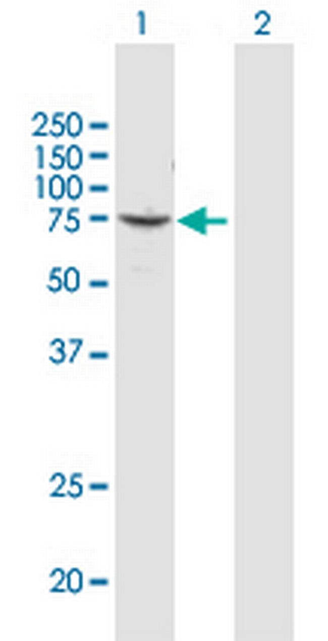 CUX1 Antibody in Western Blot (WB)