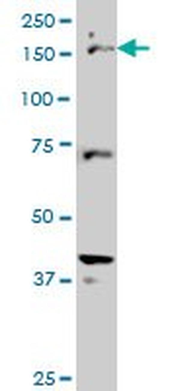 CUTL1 Antibody in Western Blot (WB)